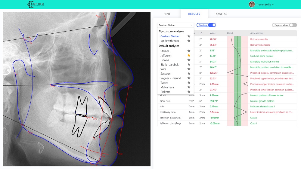 Screen from website how to analyze cephalometry